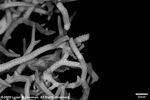 Seriatopora caliendrum var. subtilis plate10 by Katrina S. Luzon and Wilfredo Roehl Y. Licuanan